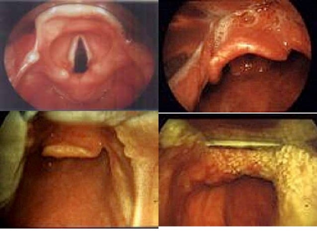 Upper airway assessment east iv