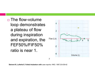 

The flow-volume
loop demonstrates
a plateau of flow
during inspiration
and expiration, the
FEF50%/FIF50%
ratio is near 1.

Steinert R, Lullwitz E. Failed intubation with case reports. HNO. 1987;35:439-42

 