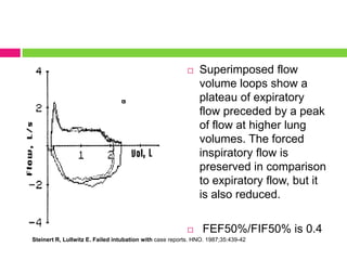 

Superimposed flow
volume loops show a
plateau of expiratory
flow preceded by a peak
of flow at higher lung
volumes. The forced
inspiratory flow is
preserved in comparison
to expiratory flow, but it
is also reduced.



FEF50%/FIF50% is 0.4

Steinert R, Lullwitz E. Failed intubation with case reports. HNO. 1987;35:439-42

 