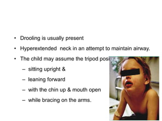 • Drooling is usually present
• Hyperextended neck in an attempt to maintain airway.
• The child may assume the tripod position,
– sitting upright &
– leaning forward
– with the chin up & mouth open
– while bracing on the arms.
 