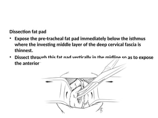 Upper airway obstruction, intubation 3eeeeeeererrer4and tracheostomy ...