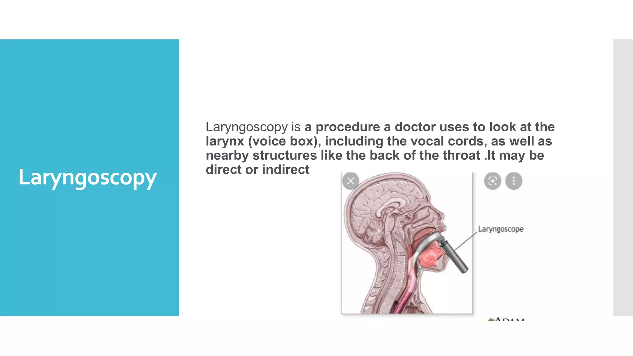 UPPER AIRWAYS OBSTRUCTION.pptx