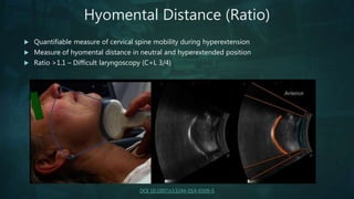 Ultrasound and the Upper Airway | PPTX