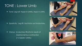 upper and lower limb examination0223.pptx