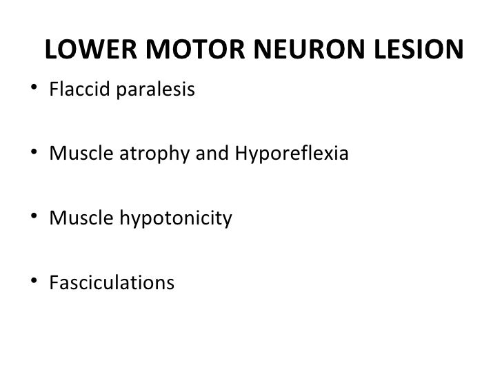upper motor neuron lesion