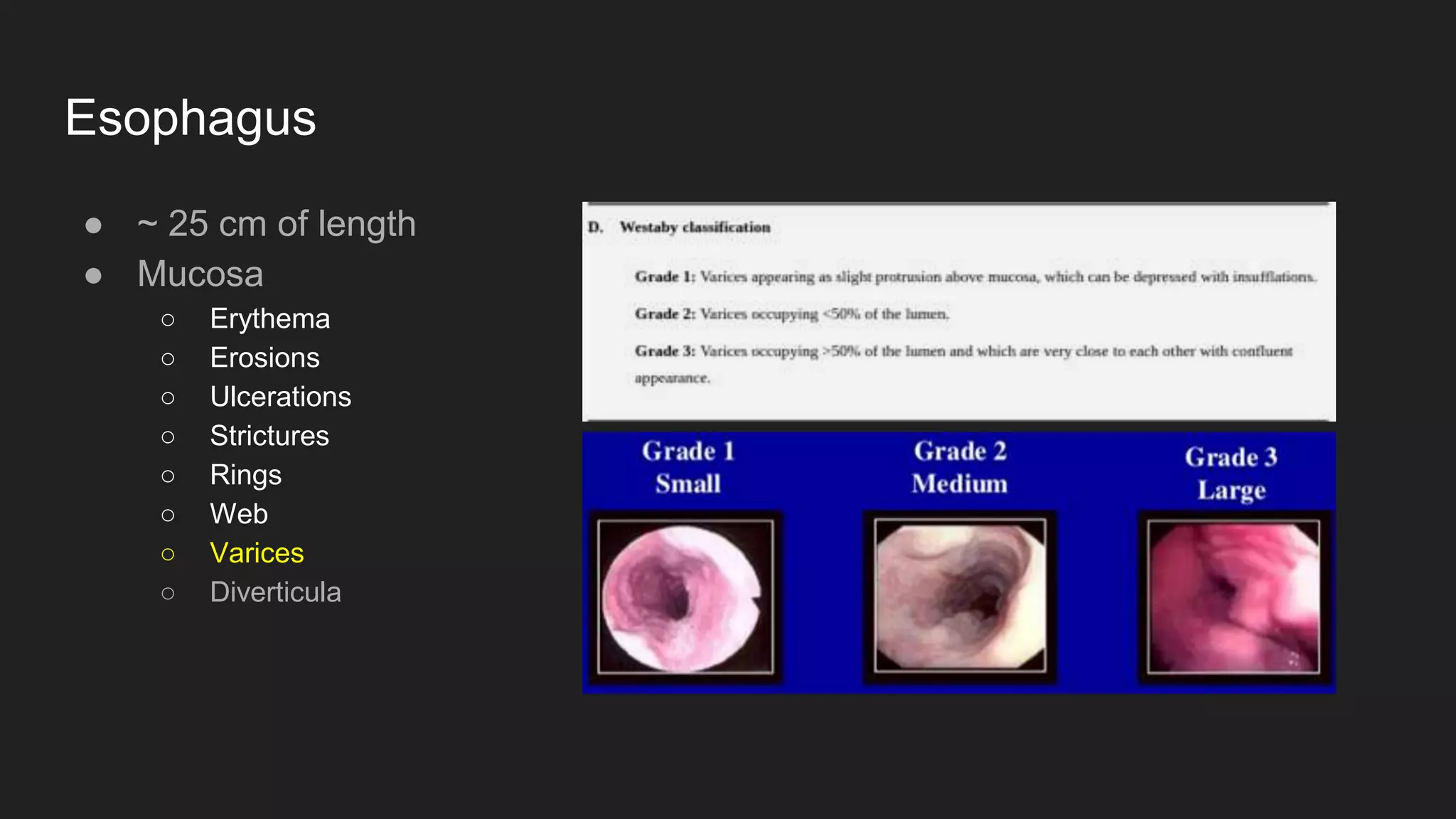 Esophagus
● ~ 25 cm of length
● Mucosa
○ Erythema
○ Erosions
○ Ulcerations
○ Strictures
○ Rings
○ Web
○ Varices
○ Diverticula
 