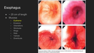 Esophagus
● ~ 25 cm of length
● Mucosa
○ Erythema
○ Erosions
○ Ulcerations
○ Strictures
○ Rings
○ Web
○ Varices
○ Diverticula
 