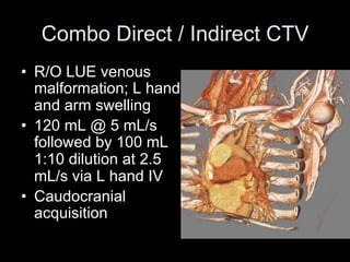 Combo Direct / Indirect CTV
• R/O LUE venous
malformation; L hand
and arm swelling
• 120 mL @ 5 mL/s
followed by 100 mL
1:10 dilution at 2.5
mL/s via L hand IV
• Caudocranial
acquisition
 