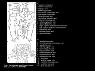 A.
1 = superior vena cava
2 = inferior vena cava
3 = azygos vein
4 = hemiazygos vein
5 = accessory hemiazygos vein
6 = ascending lumbar vein
7 = lateral thoracic vein
8 = superficial epigastric vein
9 = internal mammary vein
10 = inferior epigastric vein
11 = pericardiophrenic vein
12 = right superior (highest) intercostal vein
13 = left superior (highest) intercostal vein
14 = intercostal vein
15 = inferior phrenic vein
16 = suprarenal vein
B
1 = superior vena cava
2 = brachiocephalic (innominate) vein
3 = subclavian vein
4 = internal jugular vein
5 = external jugular vein
6 = jugular venous arch
7 = superior thyroidal vein
8 = middle thyroidal vein
9 = inferior thyroidal vein
10 = facial vein
11 = anterior jugular vein
12 = vertebral venous plexus
13 = vertebral vein, and
14 = deep cervical vein
From: Kim: J Comput Assist Tomogr, Volume
28(1).January/February 2004.24-33
 