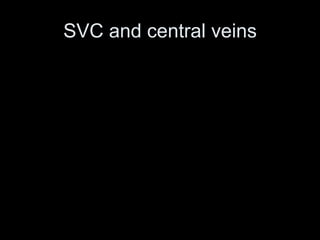 SVC and central veins
 