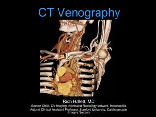 CT Venography
Rich Hallett, MD
Section Chief, CV Imaging, Northwest Radiology Network, Indianapolis
Adjunct Clinical Assistant Professor, Stanford University, Cardiovascular
Imaging Section
 