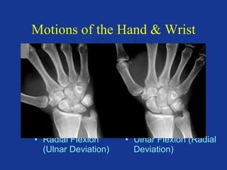 Hand Deviation Upper extremity anatomy & positioning | PPT