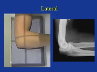 Unit Lateral Upper extremity anatomy & positioning | PPT