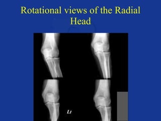 Upper extremity anatomy & positioning | PPT