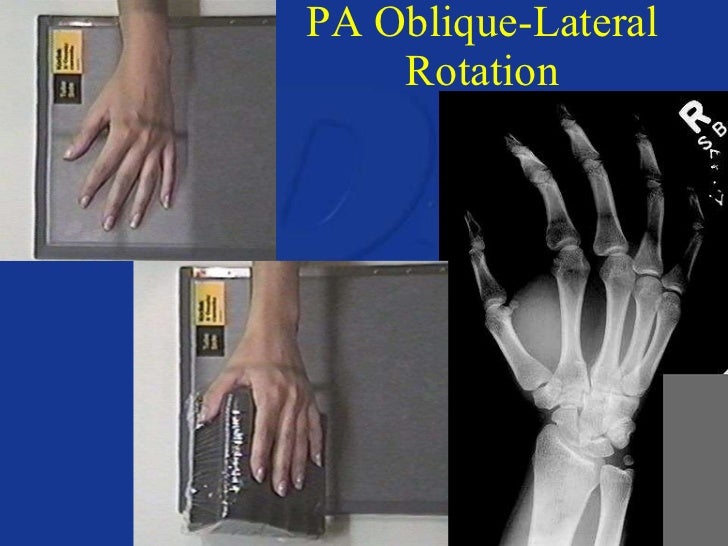 Upper extremity anatomy & positioning