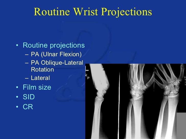 Upper extremity anatomy & positioning