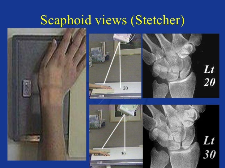 Upper extremity anatomy & positioning