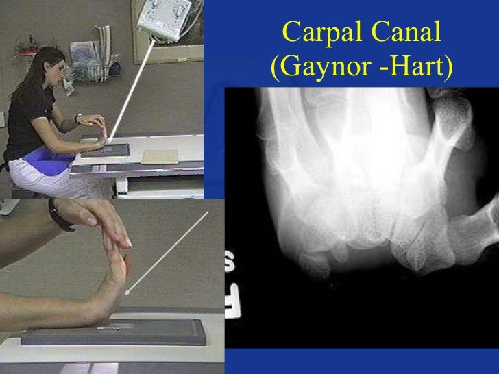 Upper extremity anatomy & positioning