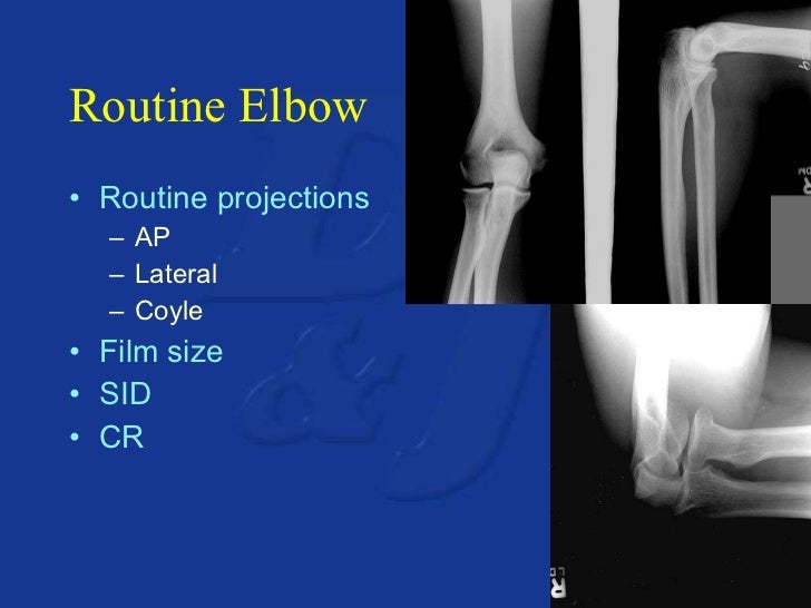 Upper extremity anatomy & positioning