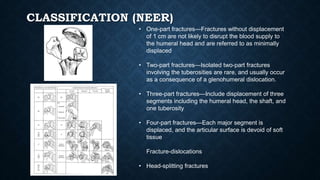 Nehr Classification Upper extremity fracture principles | PPTX