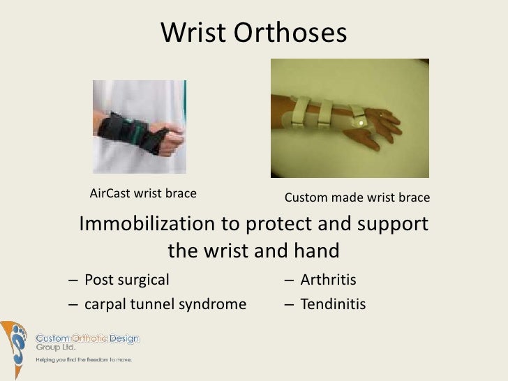 Hand, Wrist, Elbow and Arm vBraces and Splints