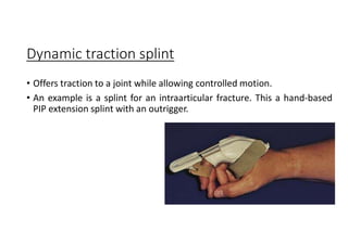 Upper extremity orthoses | PDF