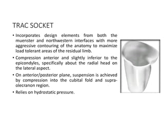 TRAC SOCKET
• Incorporates design elements from both the
muenster and northwestern interfaces with more
aggressive contouring of the anatomy to maximize
load tolerant areas of the residual limb.
• Compression anterior and slightly inferior to the
epicondyles, specifically about the radial head on
the lateral aspect.
• On anterior/posterior plane, suspension is achieved
by compression into the cubital fold and supra-
olecranon region.
• Relies on hydrostatic pressure.
 