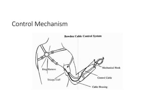 Control Mechanism
 