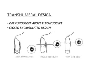 TRANSHUMERAL DESIGN
• OPEN SHOULDER ABOVE ELBOW SOCKET
• CLOSED ENCAPSULATED DESIGN
 