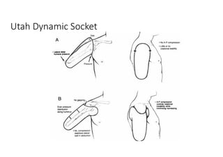 Utah Dynamic Socket
 