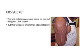 CRS SOCKET
• The anti-rotation wings are based on original
design of Utah socket.
• But this wings are smaller for added stability.
 