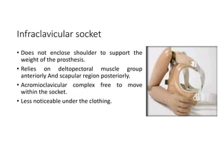 Infraclavicular socket
• Does not enclose shoulder to support the
weight of the prosthesis.
• Relies on deltopectoral muscle group
anteriorly And scapular region posteriorly.
• Acromioclavicular complex free to move
within the socket.
• Less noticeable under the clothing.
 