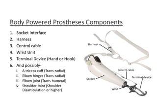 Body Powered Prostheses Components
1. Socket Interface
2. Harness
3. Control cable
4. Wrist Unit
5. Terminal Device (Hand or Hook)
6. And possibly-
i. A triceps cuff (Trans-radial)
ii. Elbow hinges (Trans-radial)
iii. Elbow joint (Trans-humeral)
iv. Shoulder Joint (Shoulder
Disarticulation or higher)
 