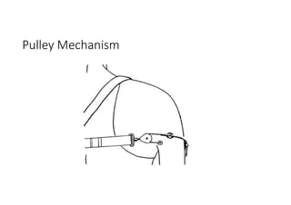 Pulley Mechanism
 