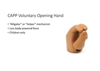 CAPP Voluntary Opening Hand
• “Alligator” or “helper” mechanism
• Less body powered force
• Children only
 