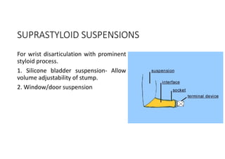 SUPRASTYLOID SUSPENSIONS
For wrist disarticulation with prominent
styloid process.
1. Silicone bladder suspension- Allow
volume adjustability of stump.
2. Window/door suspension
 