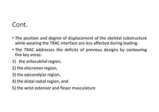 Cont.
• The position and degree of displacement of the skeletal substructure
while wearing the TRAC interface are less affected during loading.
• The TRAC addresses the deficits of previous designs by contouring
five key areas:
1) the antecubital region,
2) the olecranon region,
3) the epicondylar region,
4) the distal radial region, and
5) the wrist extensor and flexor musculature
 