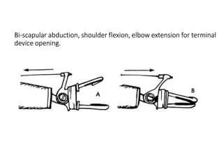 Bi-scapular abduction, shoulder flexion, elbow extension for terminal
device opening.
 