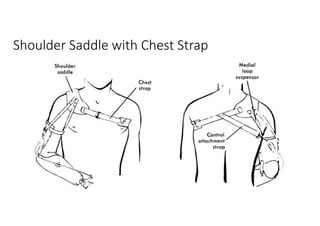 Shoulder Saddle with Chest Strap
 