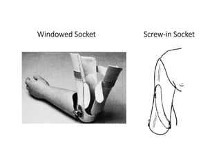 Windowed Socket Screw-in Socket
 