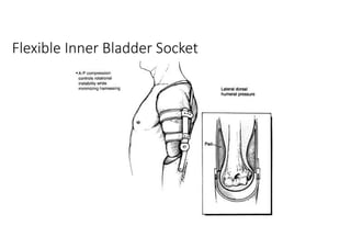 Flexible Inner Bladder Socket
 