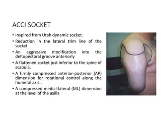 ACCI SOCKET
• Inspired from Utah dynamic socket.
• Reduction in the lateral trim line of the
socket
• An aggressive modification into the
deltopectoral groove anteriorly
• A flattened socket just inferior to the spine of
scapula,
• A firmly compressed anterior-posterior (AP)
dimension for rotational control along the
humeral axis .
• A compressed medial-lateral (ML) dimension
at the level of the axilla
 