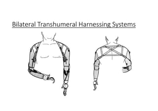 Bilateral Transhumeral Harnessing Systems
 
