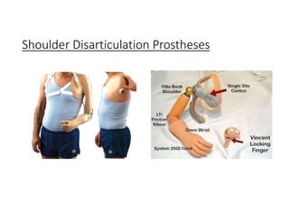 Shoulder Disarticulation Prostheses
 