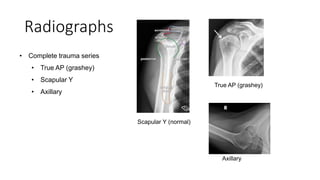 Upper extremity (shoulder fracture | PPTX