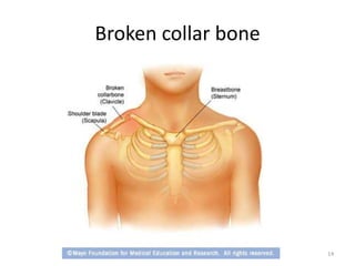 Upper extrimities and spine injuries | PPTX