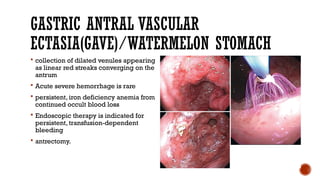 GASTRIC ANTRAL VASCULAR
ECTASIA(GAVE)/WATERMELON STOMACH
 collection of dilated venules appearing
as linear red streaks converging on the
antrum
 Acute severe hemorrhage is rare
 persistent, iron deficiency anemia from
continued occult blood loss
 Endoscopic therapy is indicated for
persistent, transfusion-dependent
bleeding
 antrectomy.
 