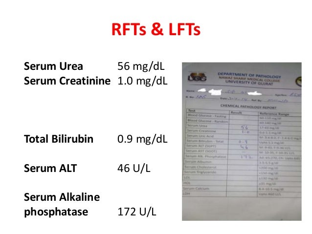 Gabapentin goodrx