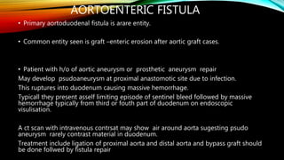 AORTOENTERIC FISTULA
• Primary aortoduodenal fistula is arare entity.
• Common entity seen is graft –enteric erosion after aortic graft cases.
• Patient with h/o of aortic aneurysm or prosthetic aneurysm repair
May develop psudoaneurysm at proximal anastomotic site due to infection.
This ruptures into duodenum causing massive hemorrhage.
Typicall they present asself limiting episode of sentinel bleed followed by massive
hemorrhage typically from third or fouth part of duodenum on endoscopic
visulisation.
A ct scan with intravenous contrsat may show air around aorta sugesting psudo
aneurysm rarely contrast material in duodenum.
Treatment include ligation of proximal aorta and distal aorta and bypass graft should
be done follwed by fistula repair
 