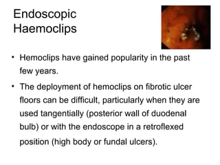 Endoscopic
Haemoclips
• Hemoclips have gained popularity in the past
few years.
• The deployment of hemoclips on fibrotic ulcer
floors can be difficult, particularly when they are
used tangentially (posterior wall of duodenal
bulb) or with the endoscope in a retroflexed
position (high body or fundal ulcers).
 